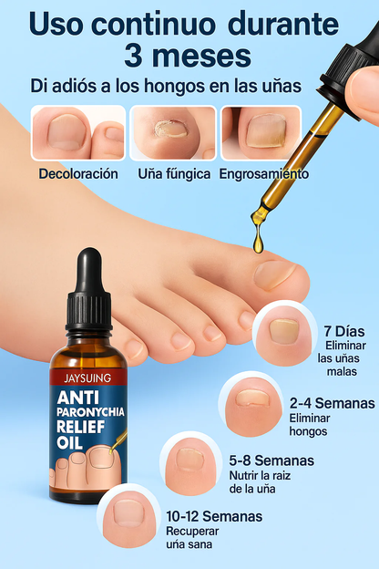 Aceite Eliminador de Hongos (2 Unidades x 1)